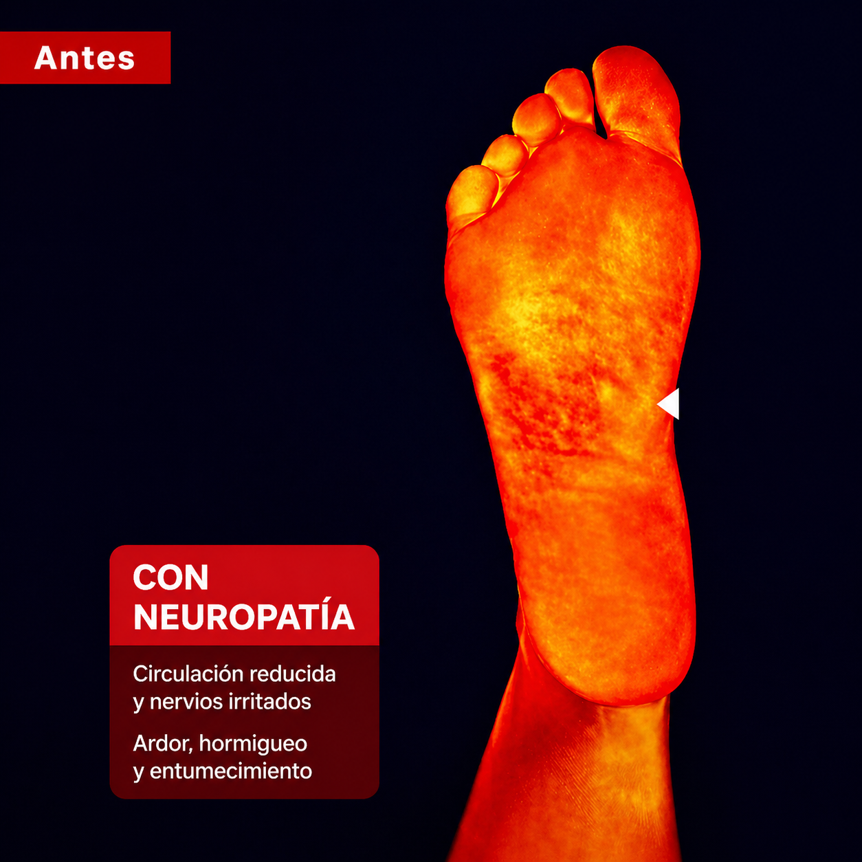 Antes